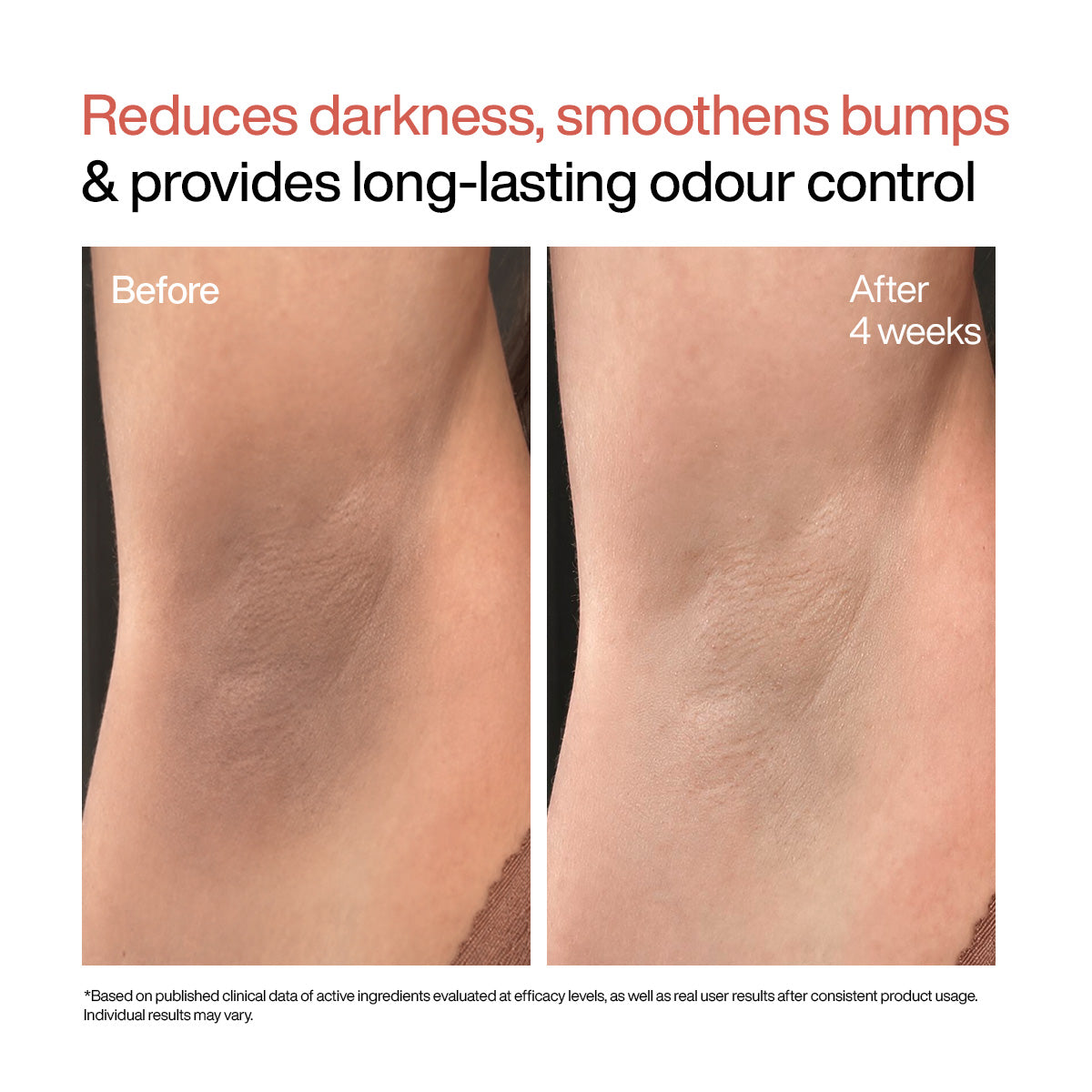 Under Arm Roll On Serum
