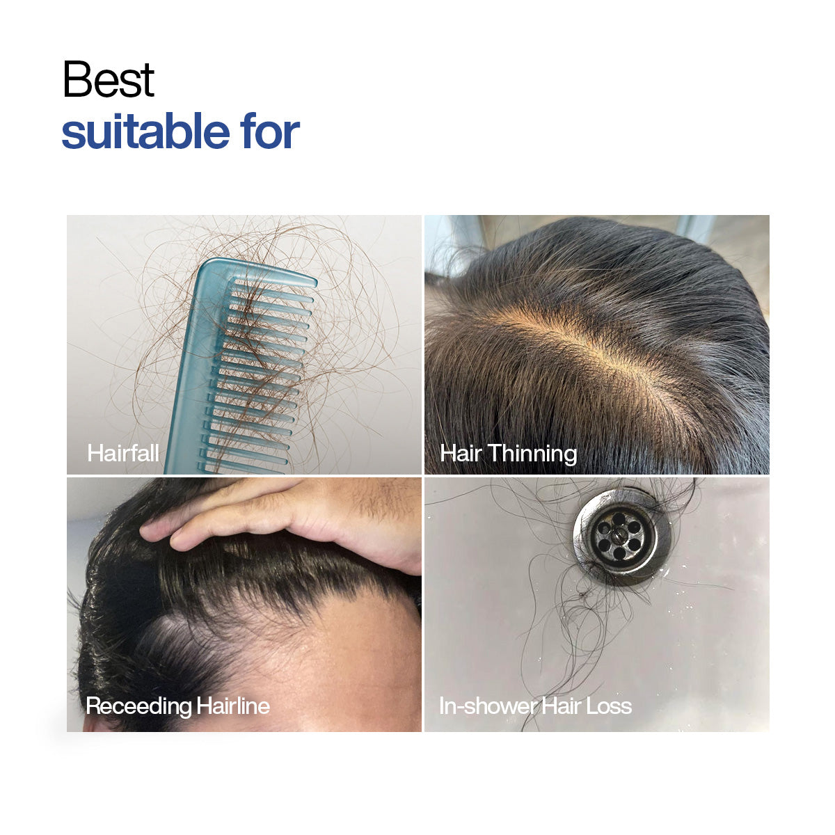 Hair Growth & Anti Hairfall Duo
