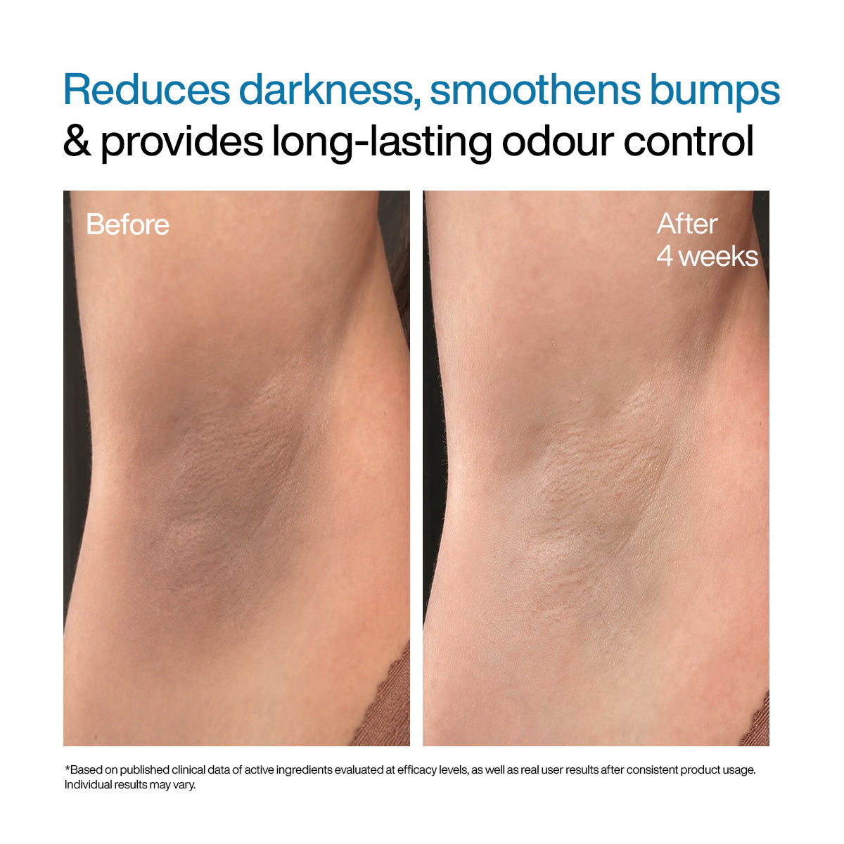 Under Arm Roll On Serum