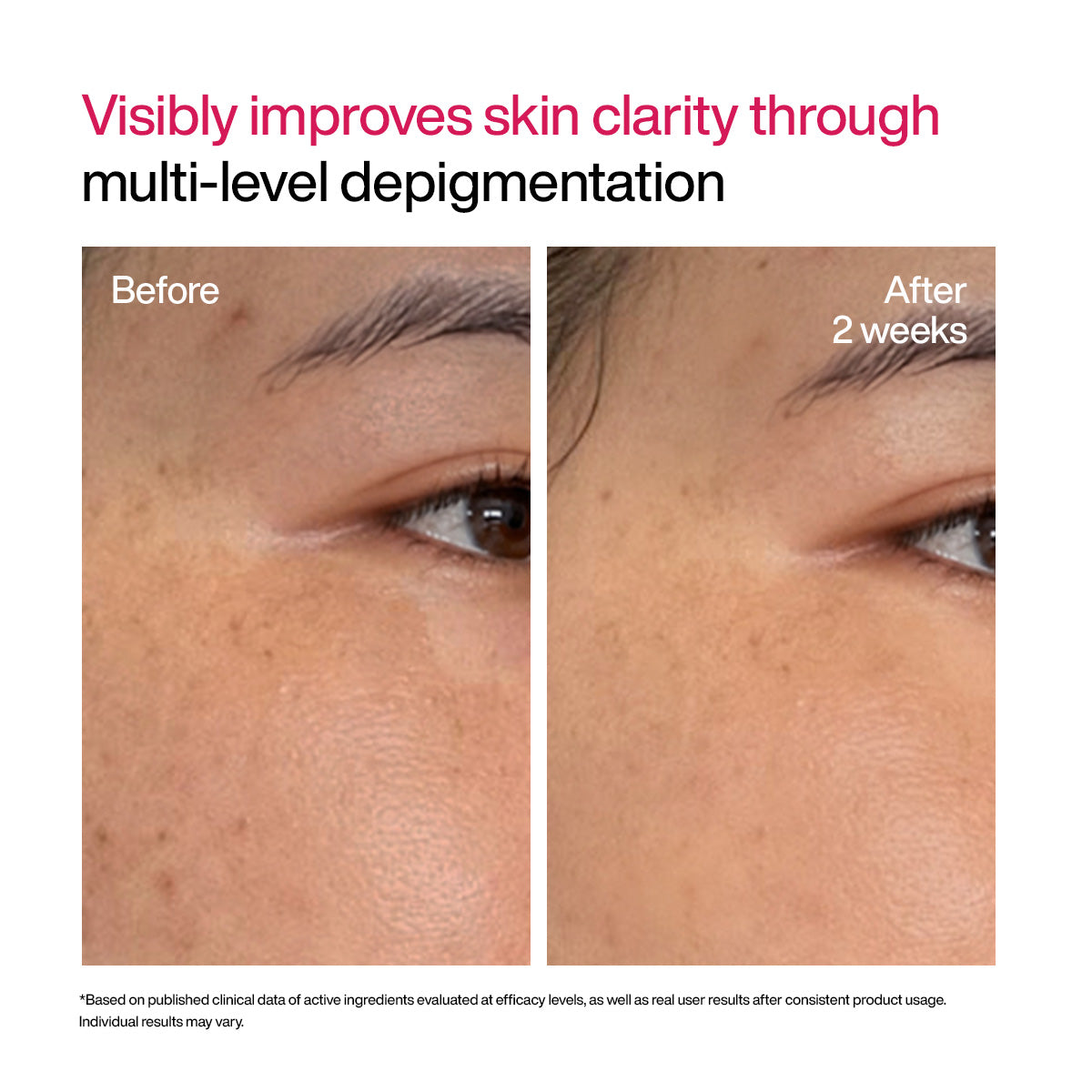 Advanced Dark Spot Correcting TXA Shot