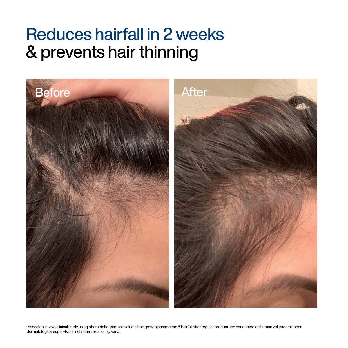 Hair Growth Serum Concentrate | 20ml