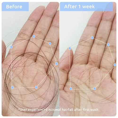 Multi Peptide Anti Hairfall Duo