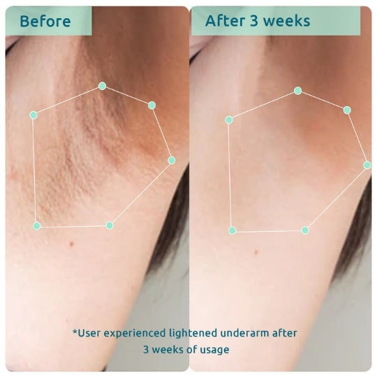 before and after images showing how the AHA underarm roll on brightens the underarm and reduces pigmentation