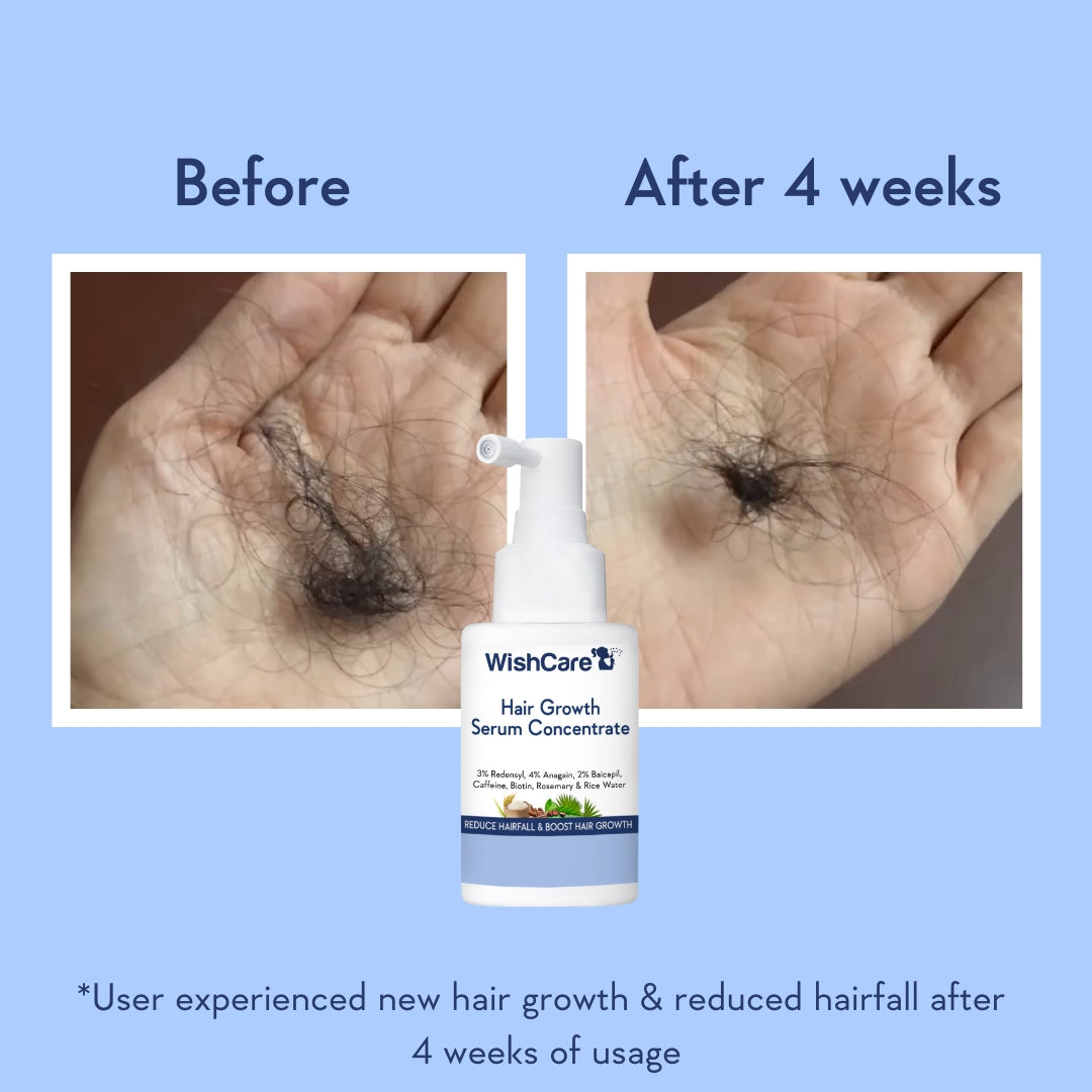 picture describing before and after images of using best hair growth serum in India