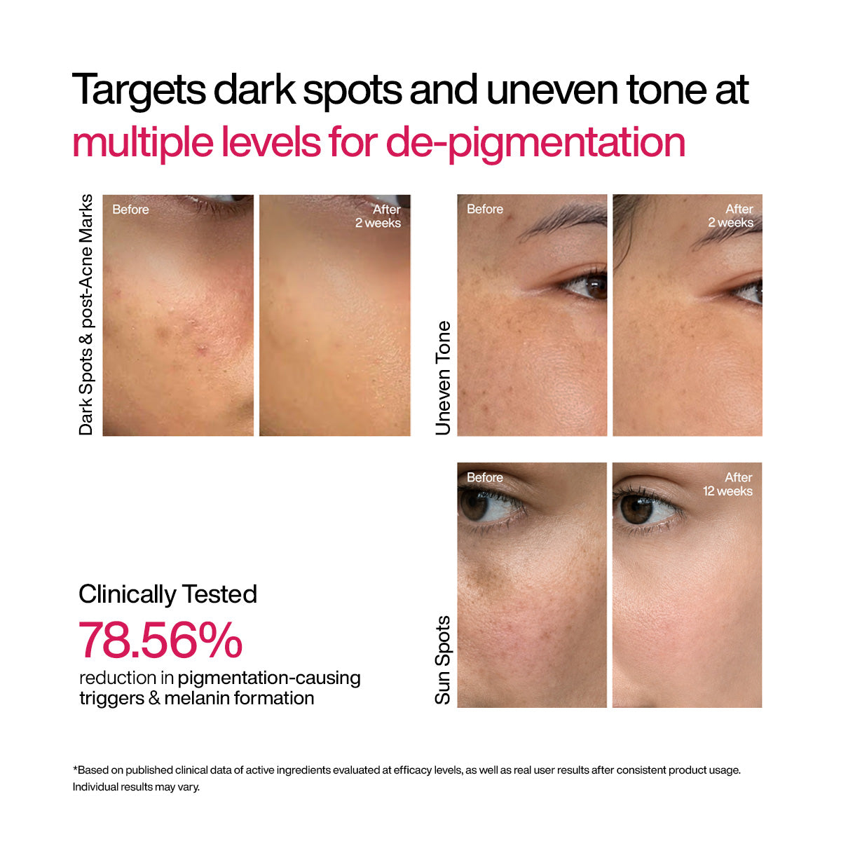 Advanced Dark Spot Correcting TXA Shot