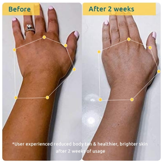 before and after images showing how the niacinamide enriched body sunscreen helps to prevent tanning