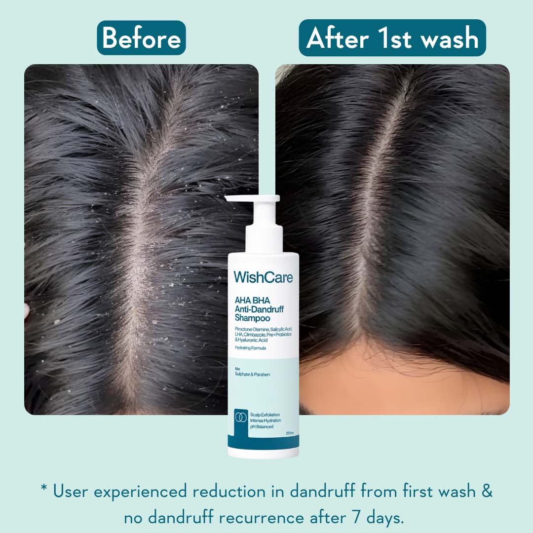 AHA BHA Anti-Dandruff Shampoo