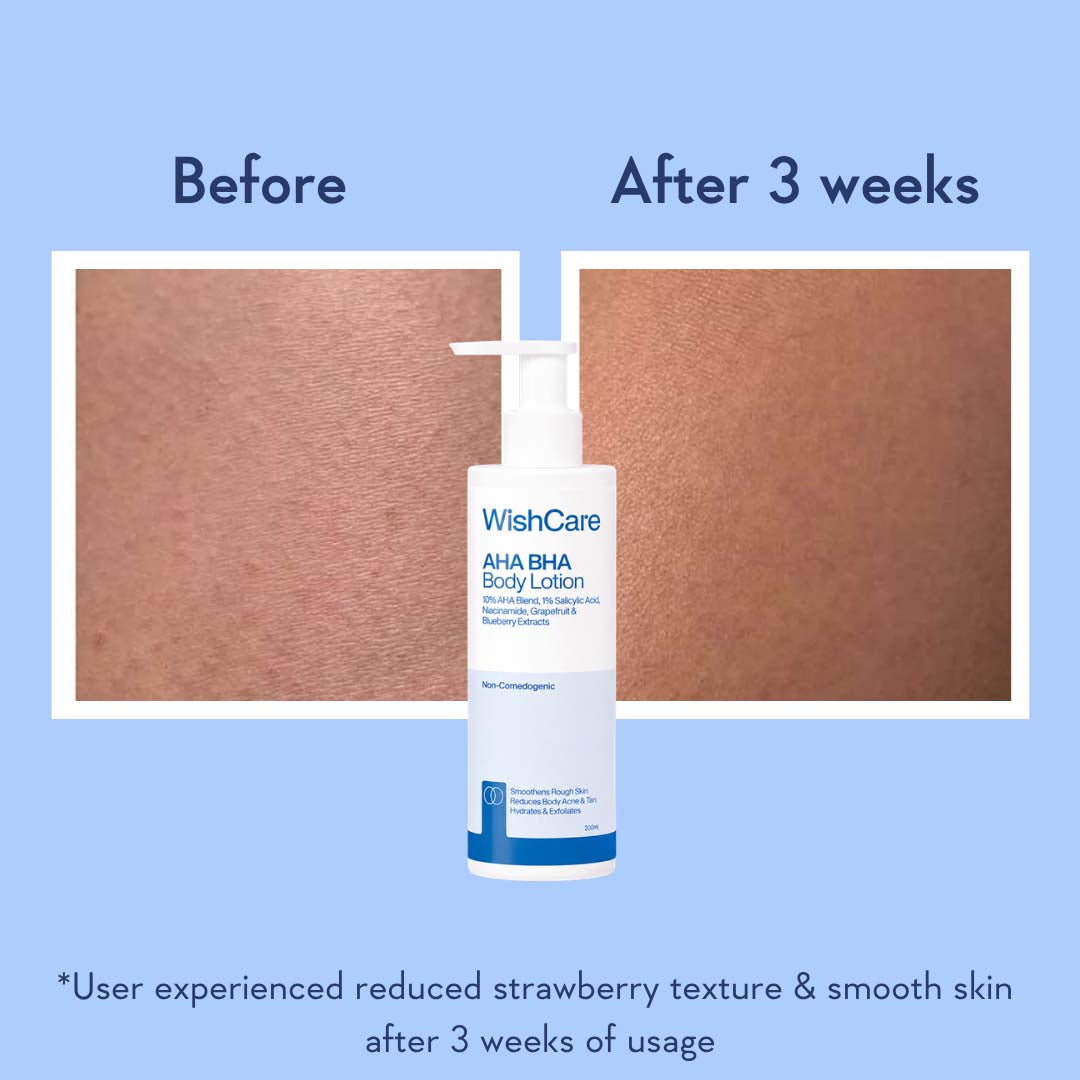 AHA BHA Body Lotion