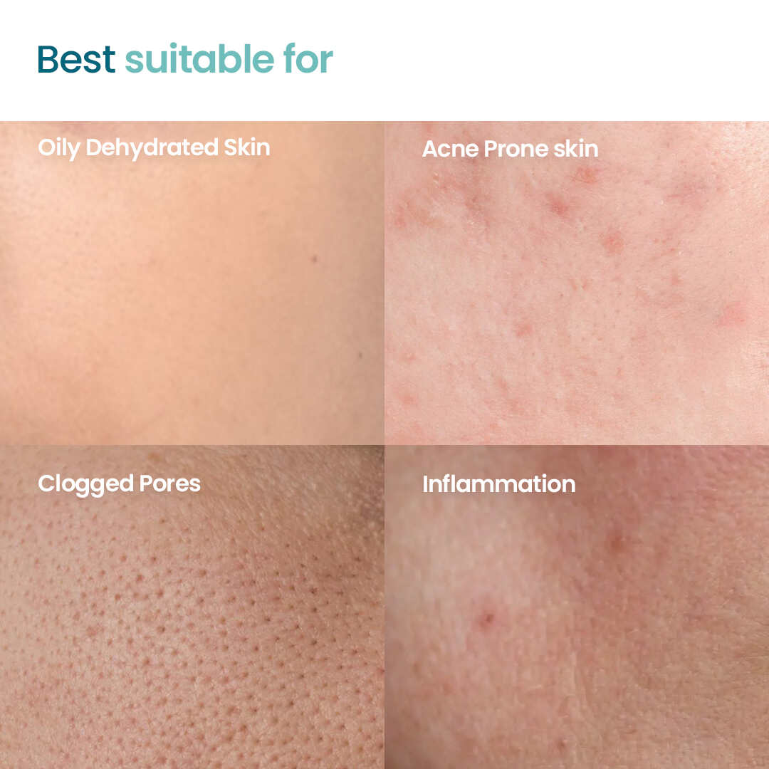 Daily Oil Balance Duo