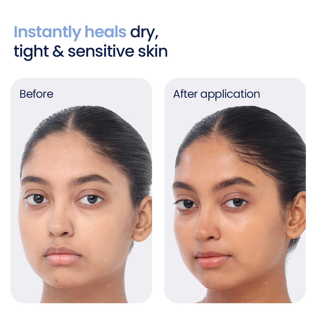 before and after images of using ceramide moisturizer