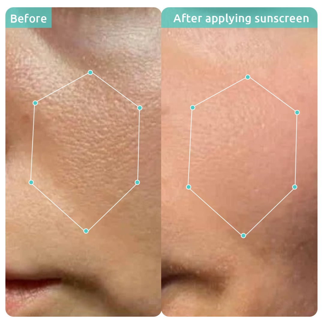 before after images after using spf50 face sunscreen