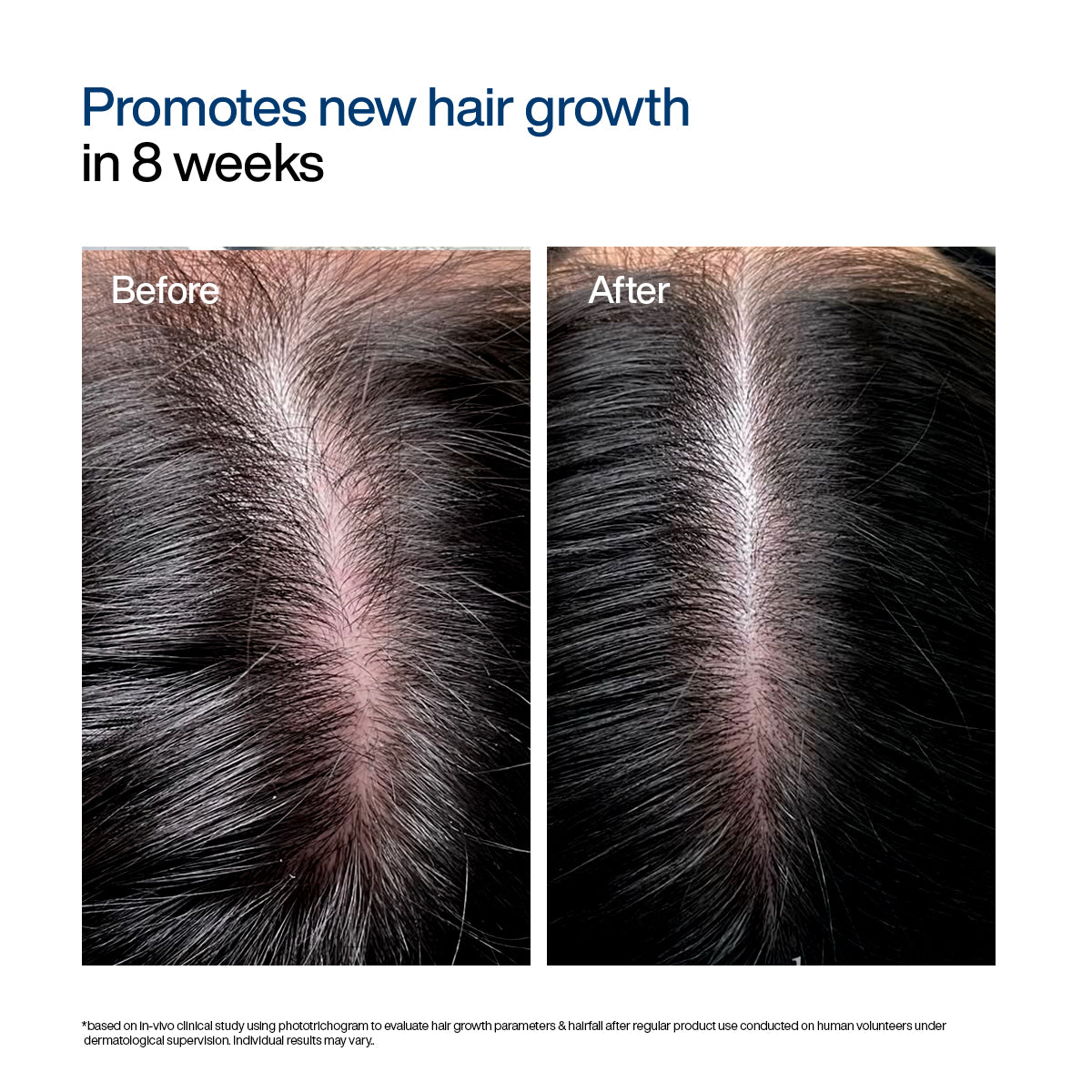 Hair Growth Serum Concentrate Roll-On | 30ml