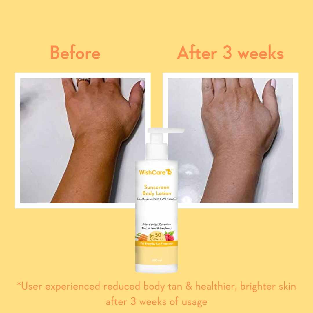 before and after images of how this body lotion hydrates and protects skin from sun