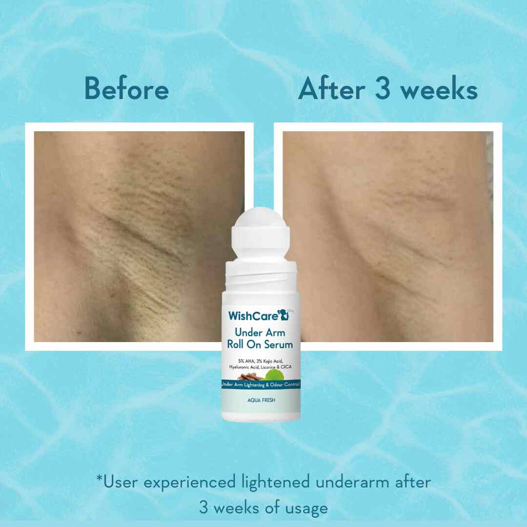 before after comparison of the underarm roll on for ladies