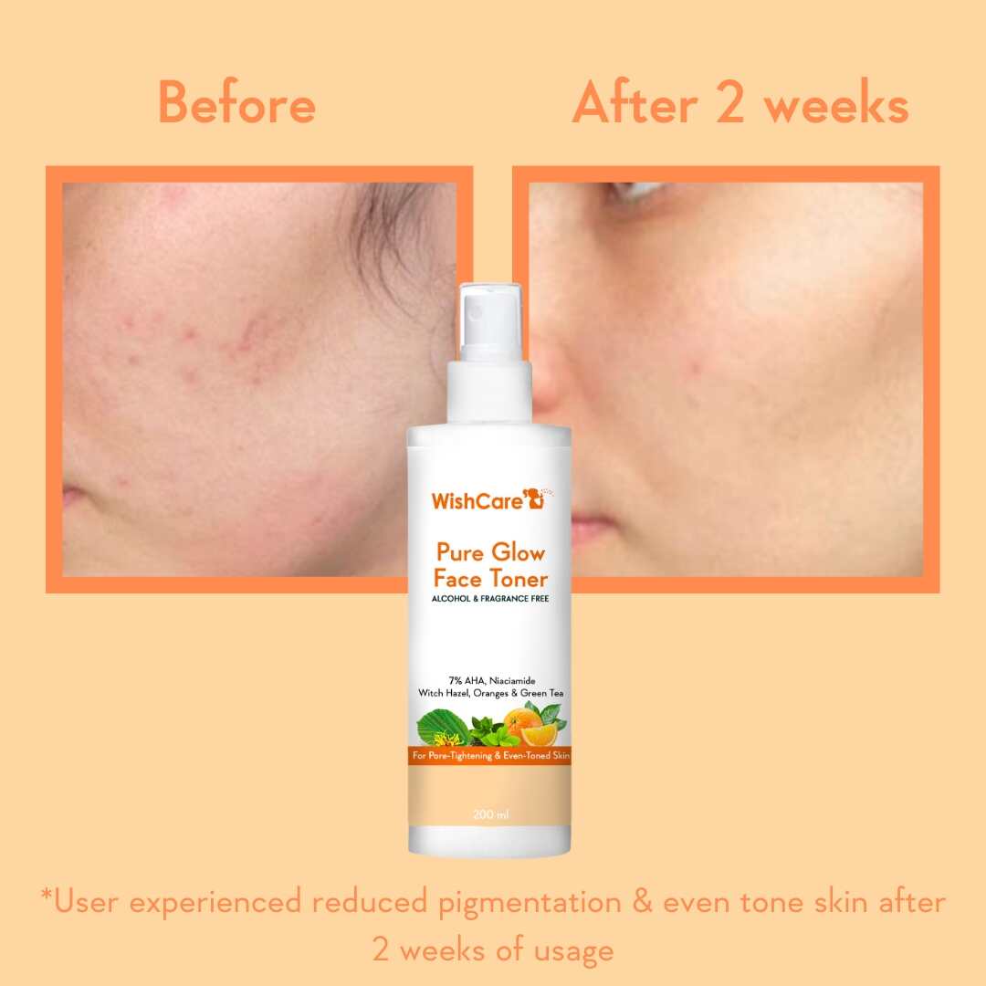 before and after image using best toner for glowing skin