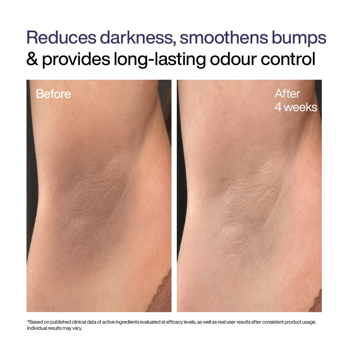 Under Arm Roll On Serum