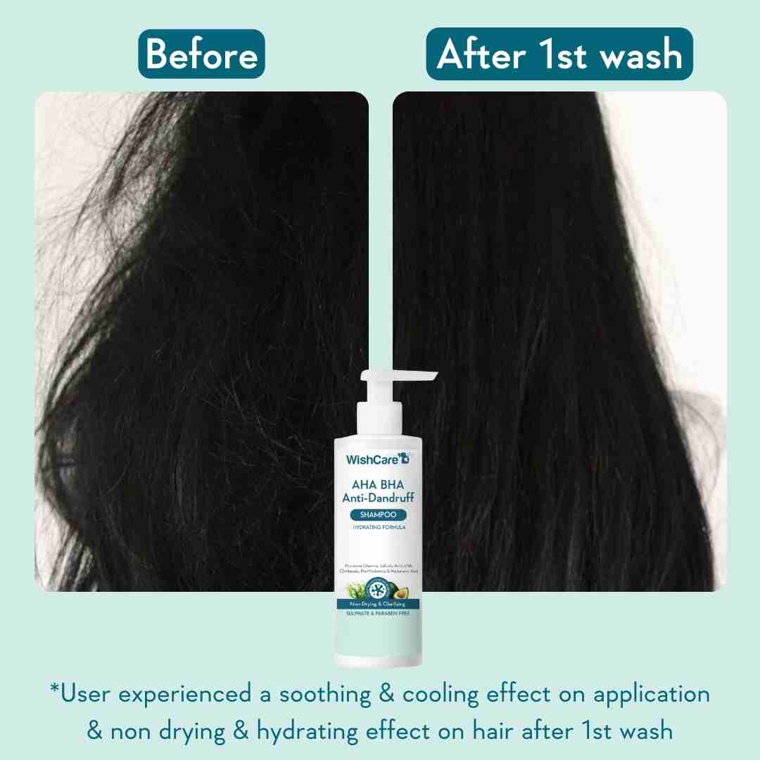 before and after images showing the effectiveness of non drying and hydrating shampoo