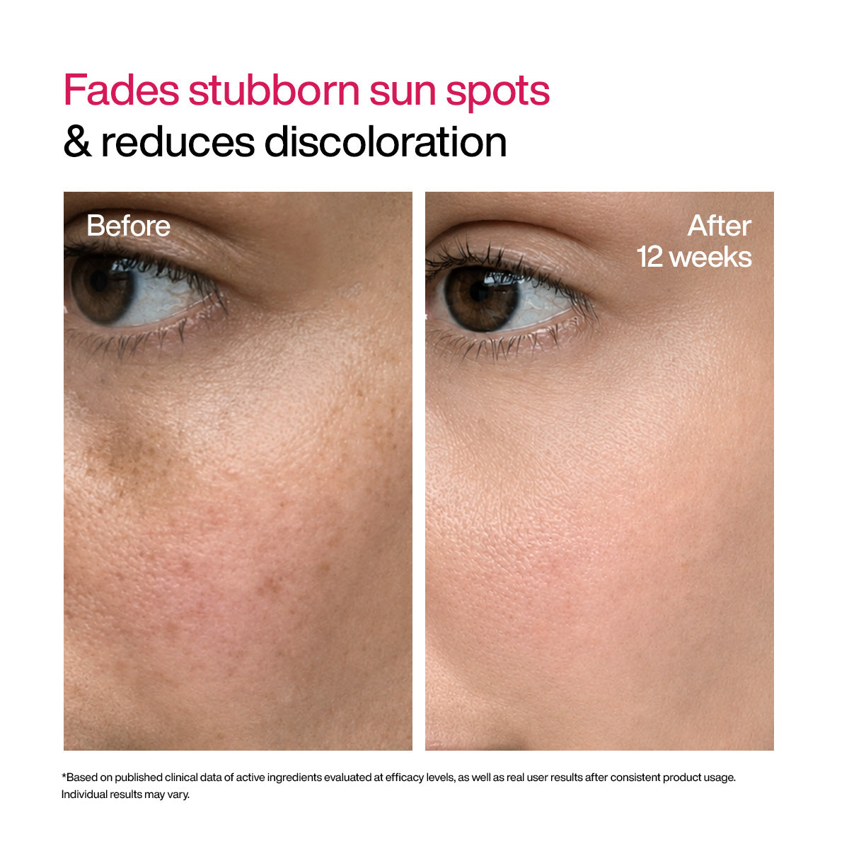 Advanced Dark Spot Correcting TXA Shot