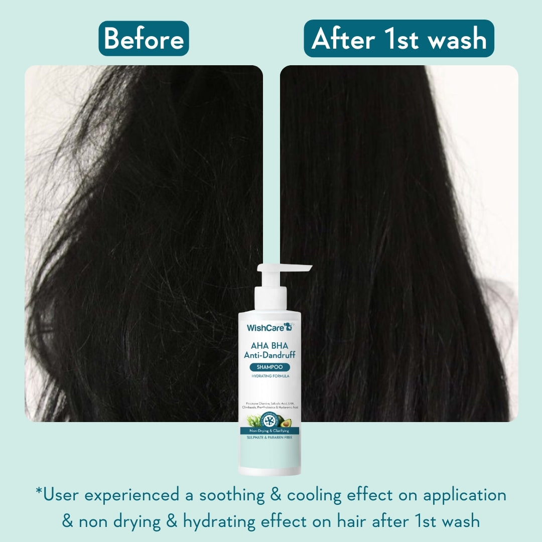 before and after images showing the effectiveness of non drying and hydrating shampoo