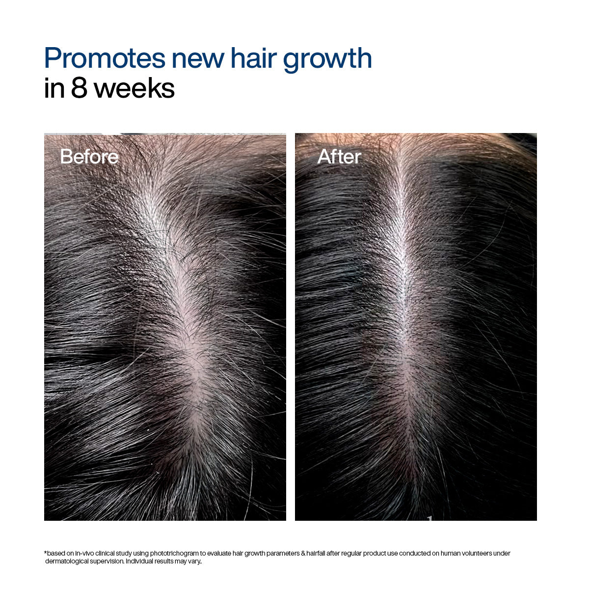 Advanced Hair Growth Foaming Serum
