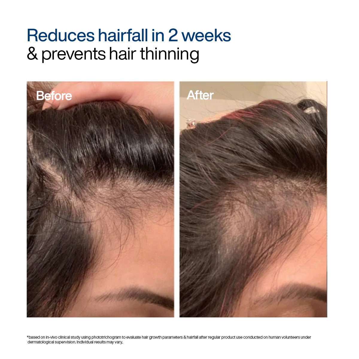 Advanced Hair Growth Foaming Serum
