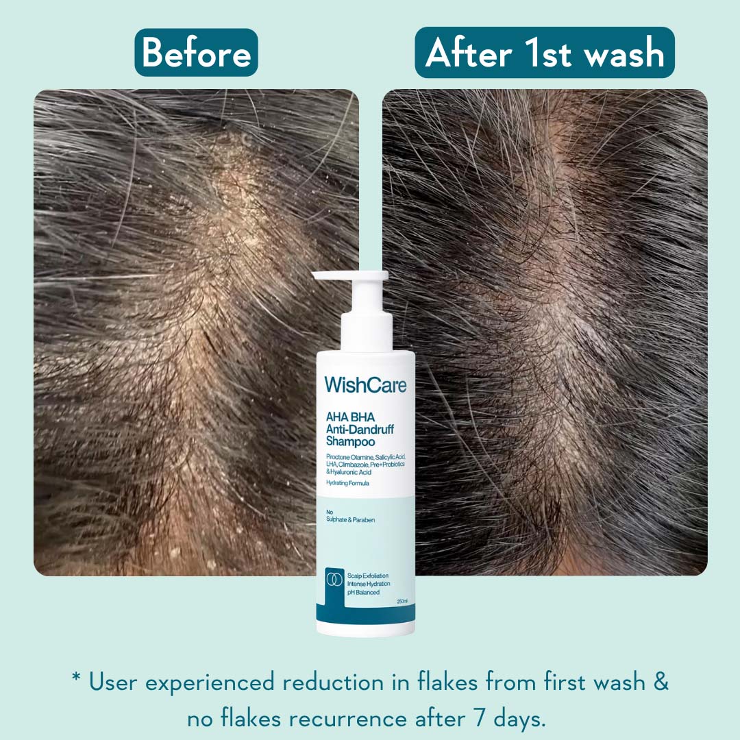 AHA BHA Anti-Dandruff Shampoo