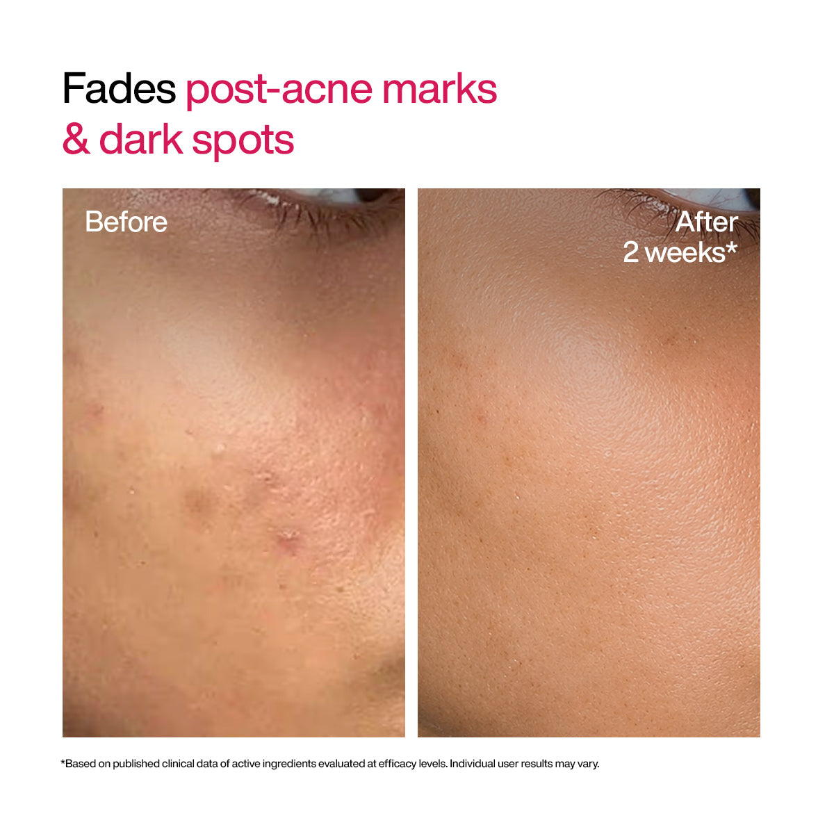 Pigmentation + Renewal: AM PM Duo