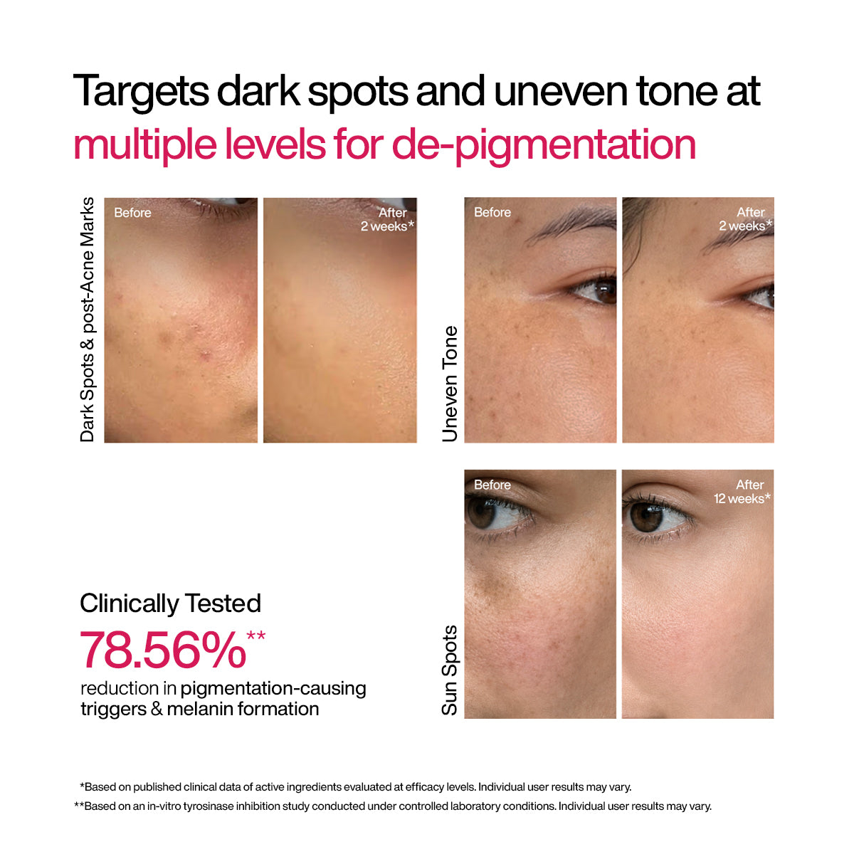 Pigmentation + Renewal: AM PM Duo
