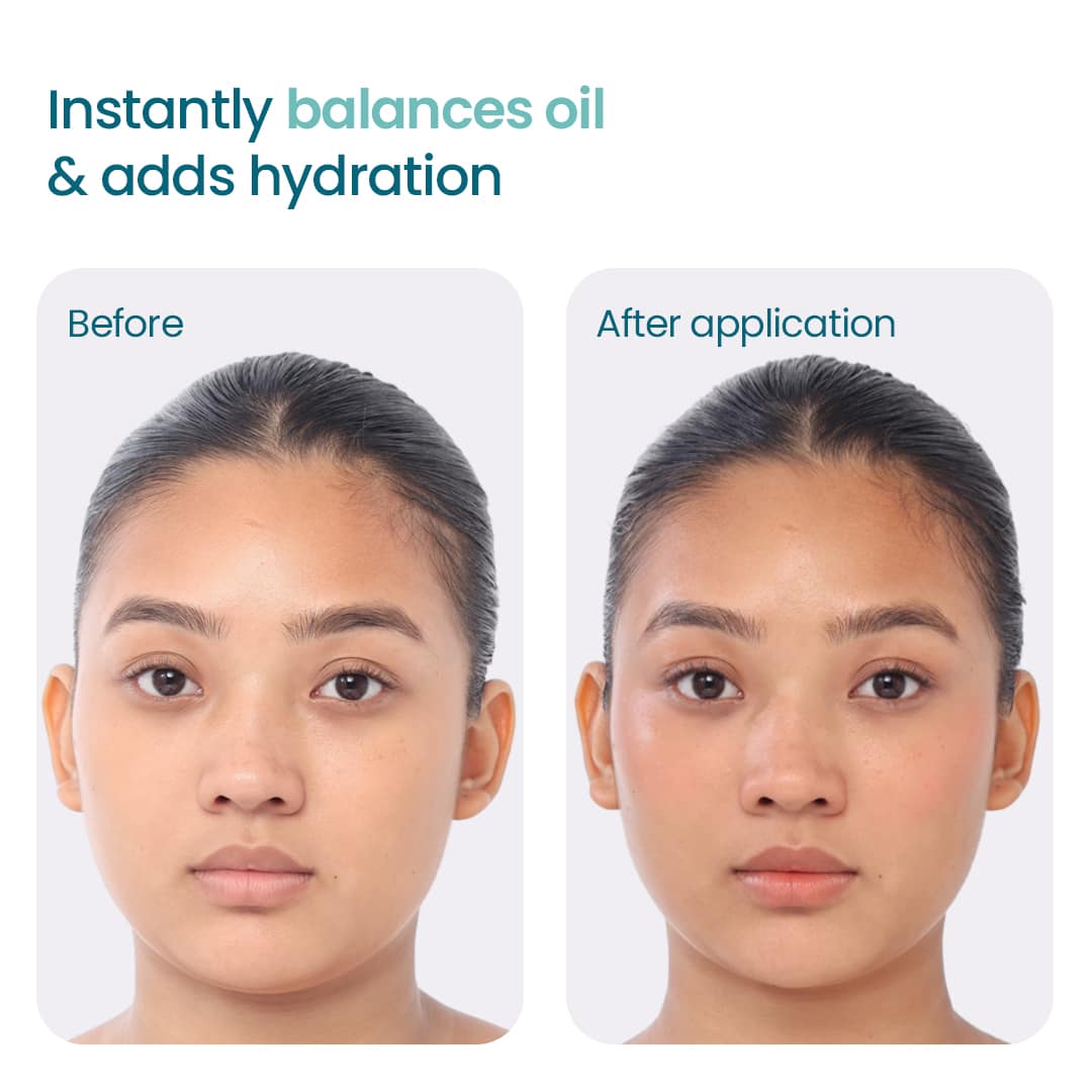 before and after images of using oil free moisturizer