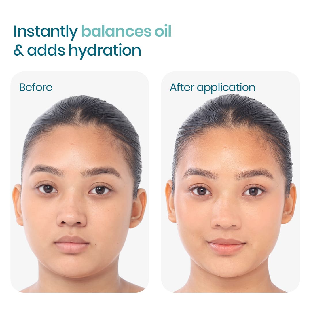 before and after images of using oil free moisturizer