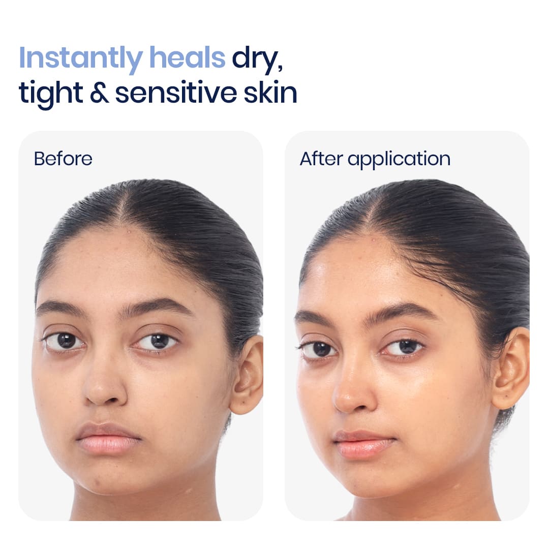 before and after images of using ceramide moisturizer