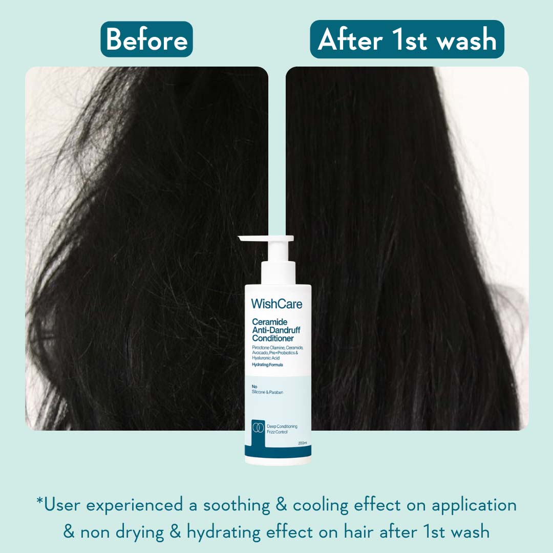 Ceramide Anti-Dandruff Conditioner