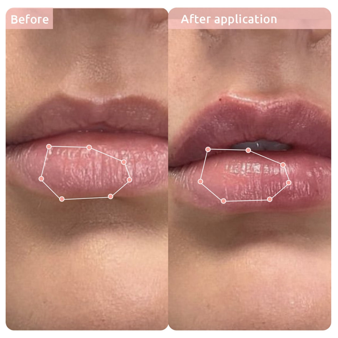 before after images after using lip balm with spf