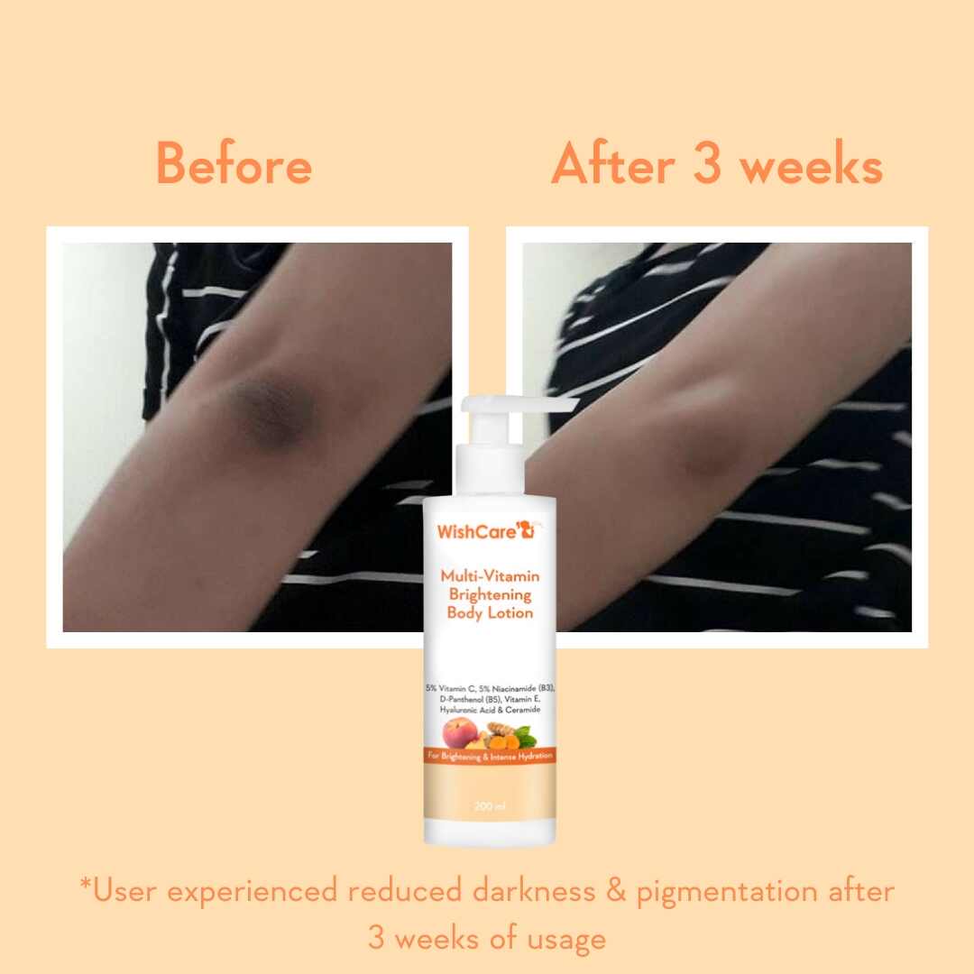 before and after results of using multi vitamin body lotion