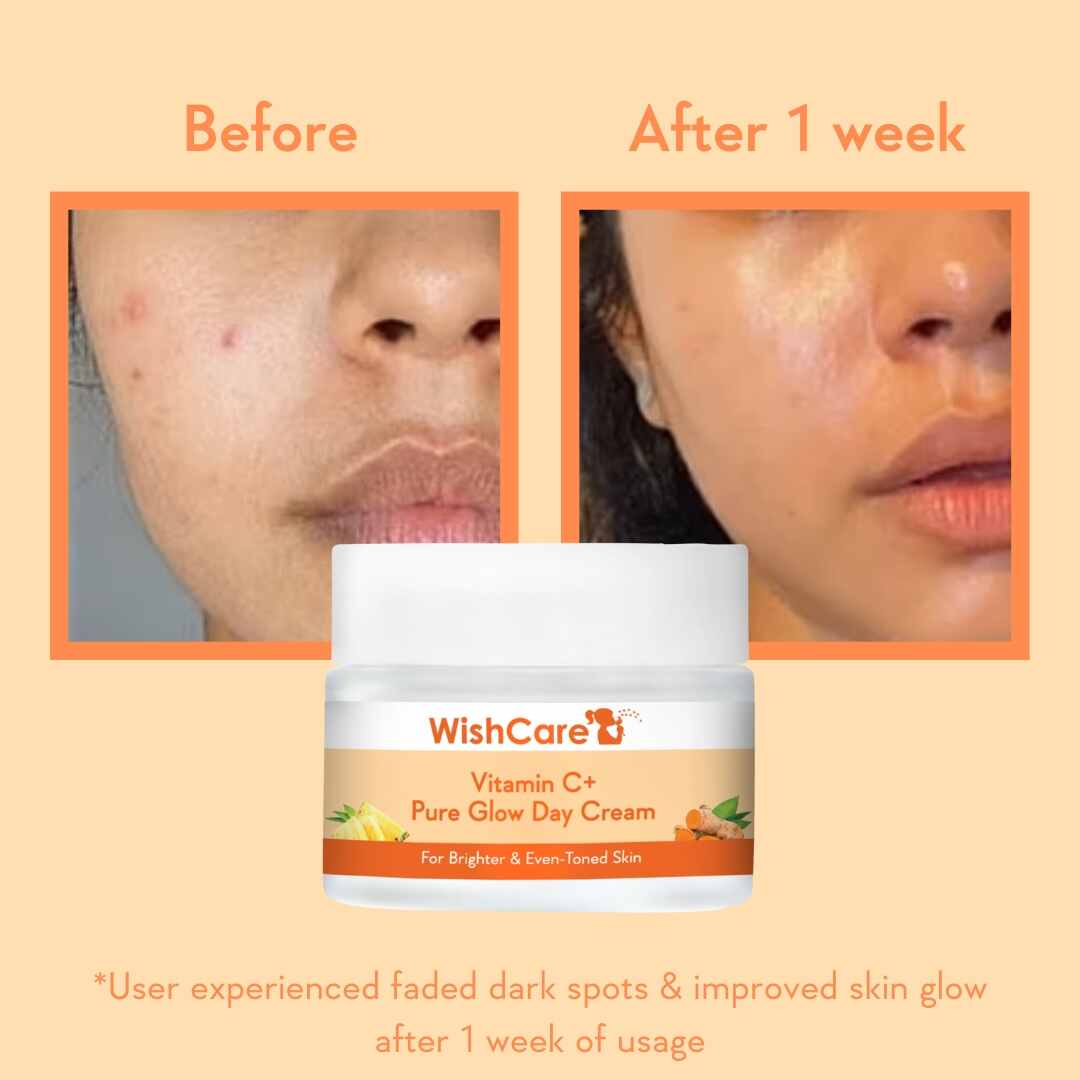 before and after effect using vitamin c face cream