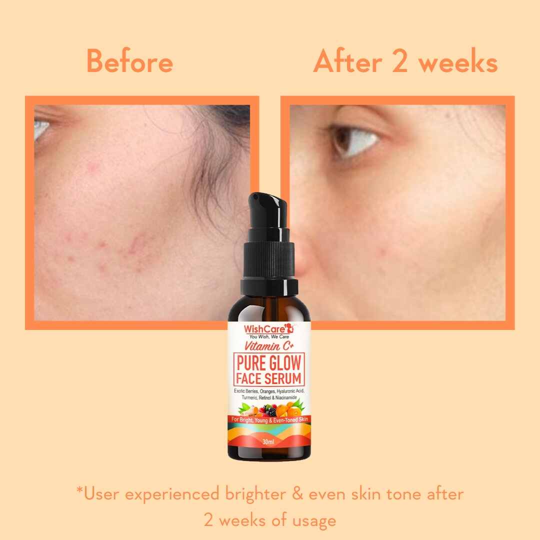picture describing before and after result of applying best serum for glowing skin
