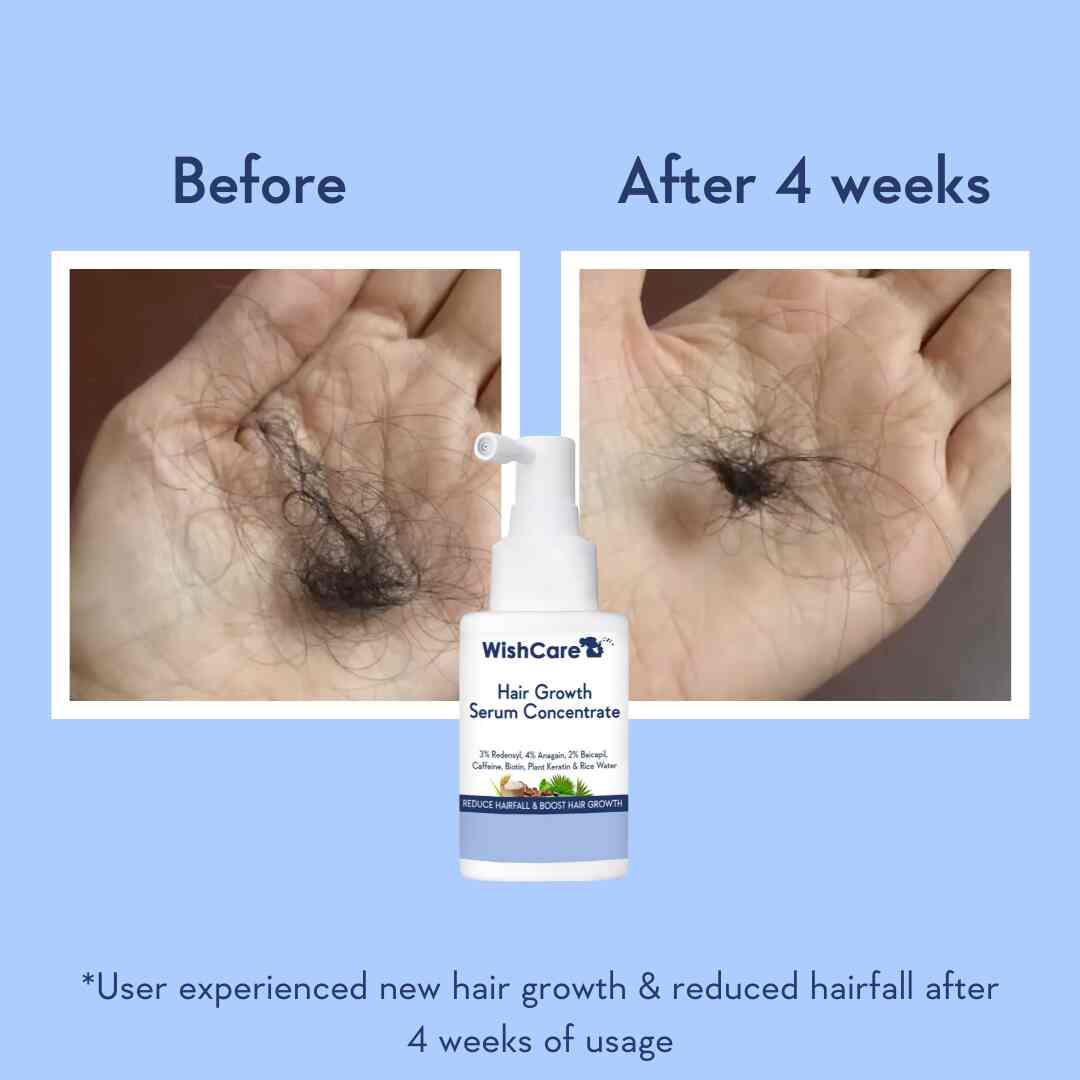 picture describing before and after images of using best hair growth serum in India